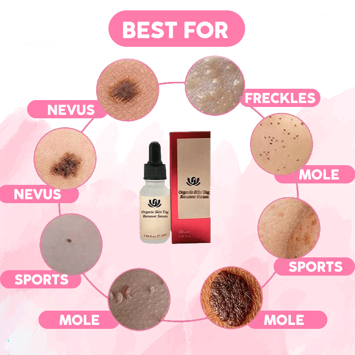 Organic Skin Spot Purifying Serum - buyooze